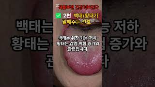 백태/황태가 말해주는건강신호 #건강정보 #건강한중년#암징조#암예방