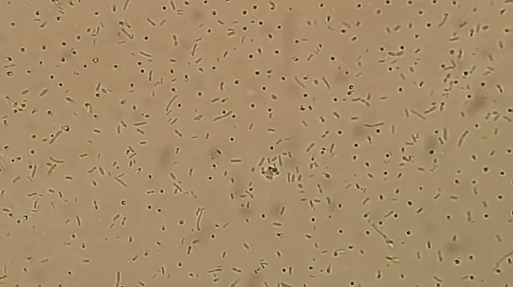 Stenotrophomonas maltophilia in wet mount of Tryptone soy broth after 3 days of incubation