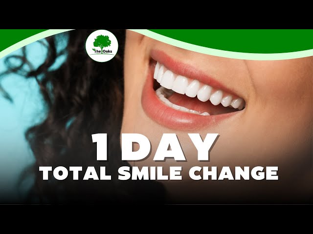 Can You Really Get a New Smile in Just 1 Day? #veneers