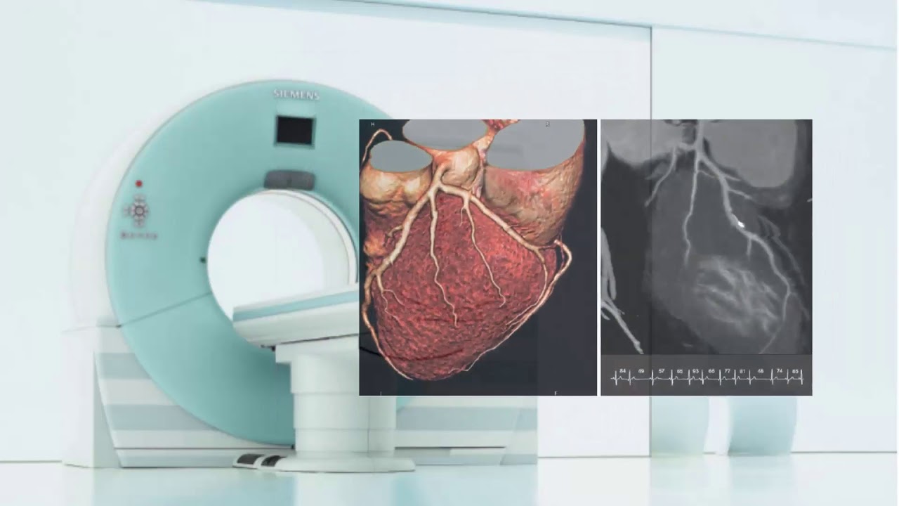 SOMATOM DEFINITION DS (SIEMENS) - YouTube