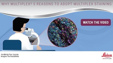 Why Multiplex? 5 Reasons to Adopt Multiplex Staining
