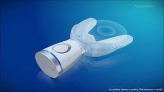 Introducing AcceleDent® Optima™
