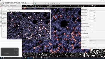 7 - Thresholds and background