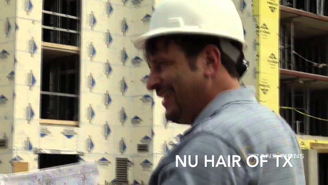 Men's Hair Replacement Dallas, TX YouTube