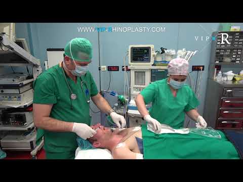 Intubation| Πώς γίνεται η διασωλήνωση| Γενική αναισθησία στο χειρουργείο| General Anesthesia