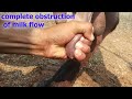 how vet treated cattle affected with teat stenosis {obstruction of milk flow } | teat constipation |