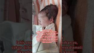 Penyebab kepala bayi memanjang setelah dilahirkan