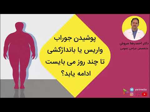 پوشیدن جوراب واریس یا بانداژکشی تا چند روز می بایست ادامه یابد