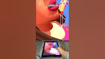 Acne runner 🤕😎 best mobile game level-13 #shorts #games #trend