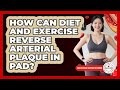 Diet and Exercise for Improved Circulation in Peripheral Artery Disease