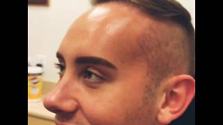 Johns 7 Month Follow Up to Neograft Hair Restoration | Dr. David P. Rapaport NYC