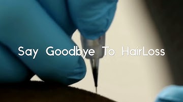 Scalp Micro Pigmentation @ Creative Scalps