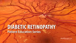 Diabetic Retinopathy