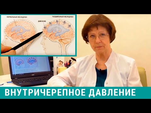 Внутричерепное давление лечение в домашних условиях