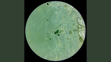 In un momento ero smarrito