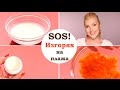 SOS! Изгорях на плажа - домашни трикове срещу болката