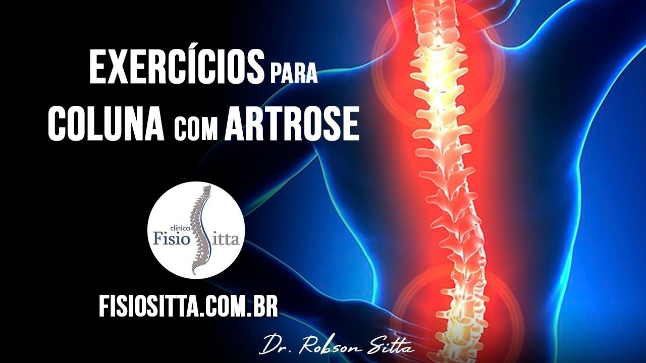 EXERCÍCIOS ARTROSE da COLUNA VERTEBRAL MELHORA da DOR e MOBILIDADE - Fisioterapia Dr. Robson Sitta