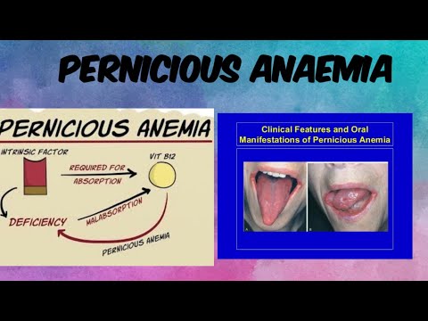 | PERNICIOUS ANAEMIA