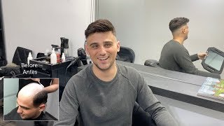 Hair Replacement fitting video (Alex) part 3 – Hair Inspira