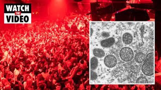 WHO blames monkeypox outbreak on sex raves