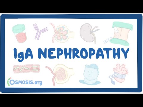 آئی جی اے نیفروپیتھی - اسباب، علامات، تشخیص، علاج، پیتھالوجی