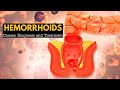 Hemorrhoids or Piles, Causes,Signs and symptoms, Diagnosis and Treatment