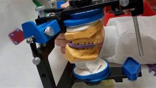 Verifying Accuracy of Mounted Casts on Articulator - Dr. Mark R. Taylor