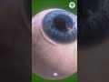 Eyesight Precision 👀🧿👁️ #shorts #eyesight
