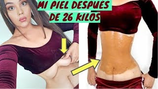 COMO ELIMINAR LA FLACIDEZ| MI PIEL DESPUÉS DE 26 KILOS