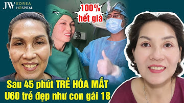 Bệnh viện JW CẮT DA MẮT kết hợp Midface 3 in 1 NÂNG CƠ quý cô U60 TRẺ NHƯ GÁI 18 sau một giấc ngủ