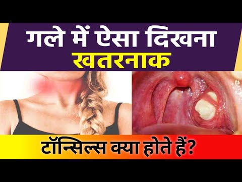 वीडियो: क्या तल्लुल्लाह एक आयरिश नाम है?