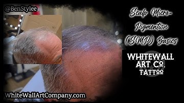 Is Scalp-Micropigmentation (SMP) Right for You?