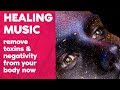 *POWERFUL ❯ SOL 741 Hz ❯ Music to remove toxins ❯ Repair your Body | Solfeggio music