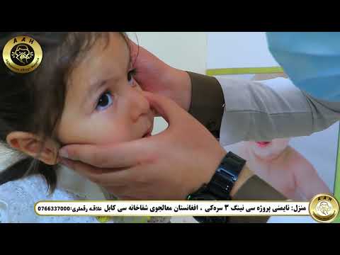 افغانستان معالجوی باله لر شفاخانه سی