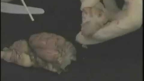 BrainU Sheep Brain Dissection - Part 2