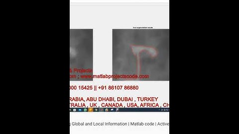 Active Contour Model Integrating Global and Local Information - Matlab code - Active Contour model