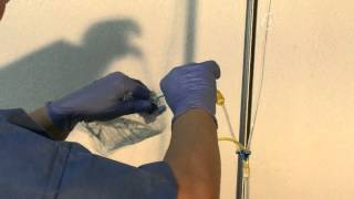 2 Verabreichung Des 3-Teiligen Onkoset Sn 1206 A