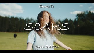 Keenan Te - Scars ( Darwin Skidzi Rmx ) New!!