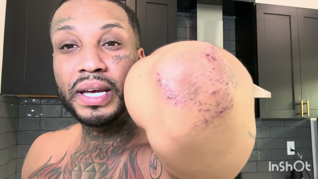 Last Day In Houston I Got Hit By A Car but I Moved to LA  