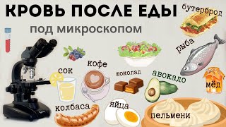 Кровь разных людей после разных продуктов питания.  Сгущение крови - от чего ?