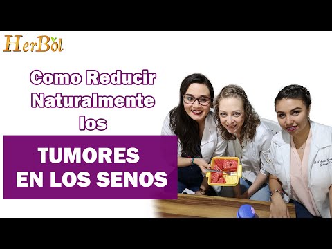 Vídeo: Fibroadenoma: Tratamiento Del Fibroadenoma Con Remedios Y Métodos Caseros