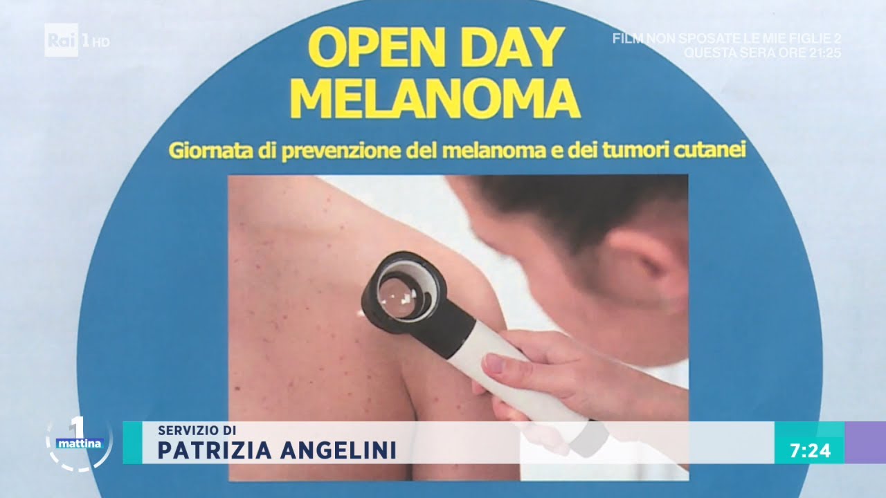 Lotta al melanoma - Unomattina - 10/06/2021