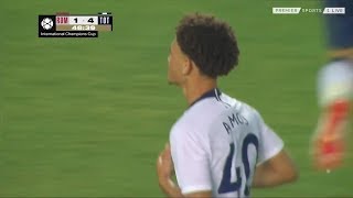 Luke Amos vs Roma (Pre-Season 2018)