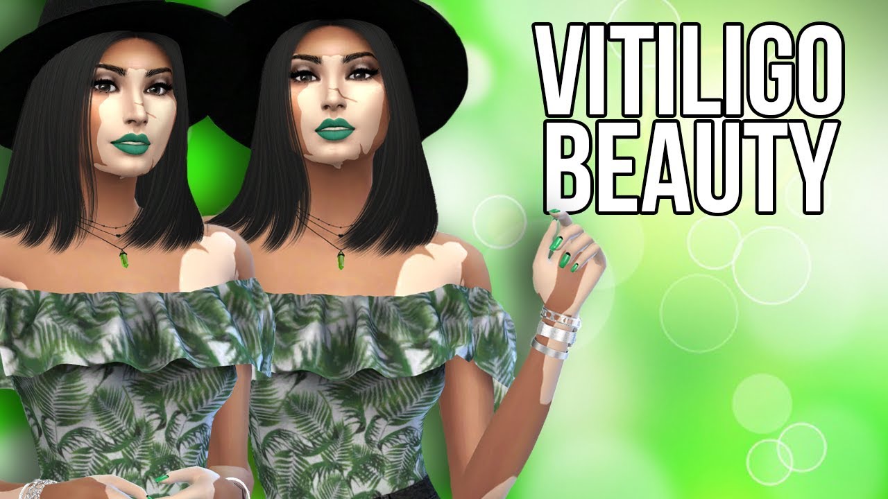 The Sims 4: Create A Sim || Vitiligo Beauty