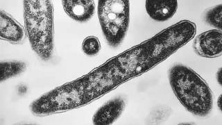 2nd person died from Legionnaires' outbreak on Upper East Side