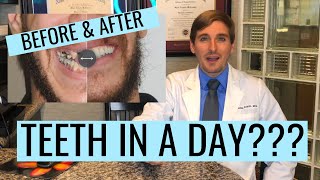 Dental Implants- How They Fixed Their Smiles
