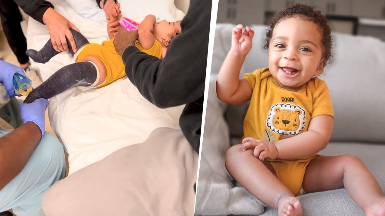 Kai Got His Casts Removed…