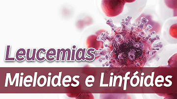Qual a diferença entre leucemia mieloide e linfóide?