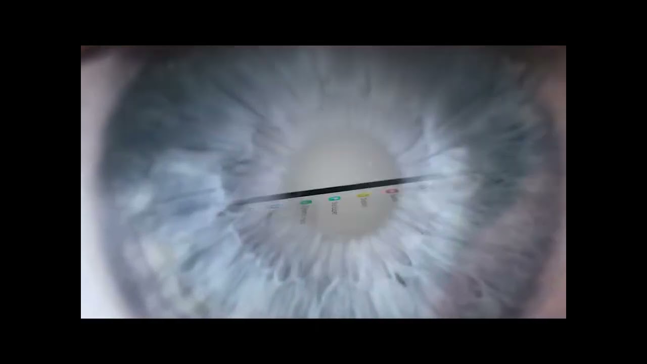 2dbbd9f9 b2b5 4a77 946e 9f7eac95e2de h265 hd
