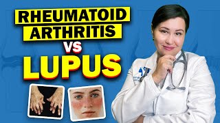 What ?! Can you have both Rheumatoid Arthritis and Lupus ?